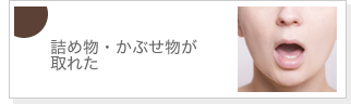 詰め物・かぶせ物が取れた